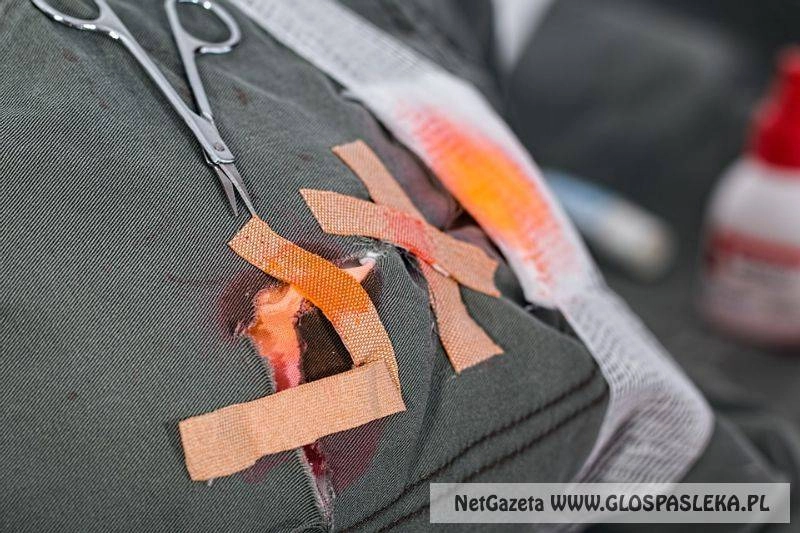 Ubezpieczenie NNW, a świadczenia dla poszkodowanych. 