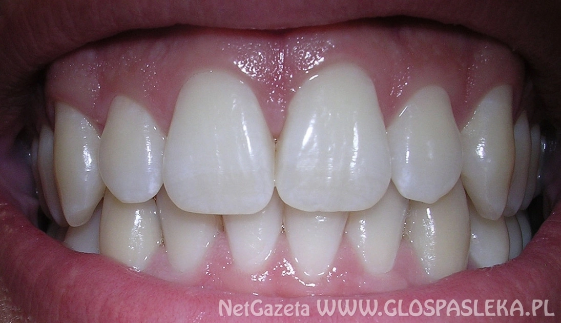 Stomatolodzy do szkół